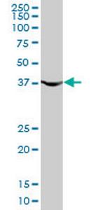 PGK1 Antibody in Western Blot (WB)