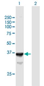 SLC25A3 Antibody in Western Blot (WB)