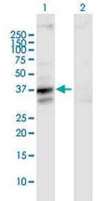 SLC25A3 Antibody in Western Blot (WB)