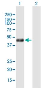 PHKG2 Antibody in Western Blot (WB)