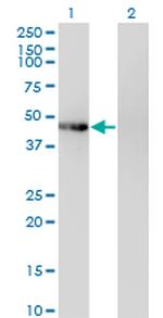 PHKG2 Antibody in Western Blot (WB)