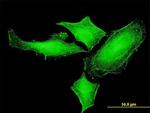 PIM1 Antibody in Immunocytochemistry (ICC/IF)