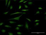 PIN4 Antibody in Immunocytochemistry (ICC/IF)