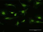 PITX1 Antibody in Immunocytochemistry (ICC/IF)