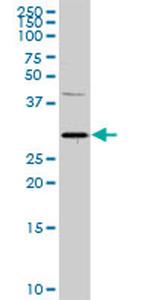 PITX1 Antibody in Western Blot (WB)