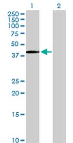 PITX1 Antibody in Western Blot (WB)