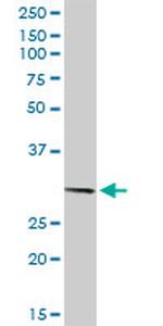 PITX2 Antibody in Western Blot (WB)