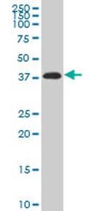 PITX2 Antibody in Western Blot (WB)