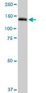 PLCG2 Antibody in Western Blot (WB)