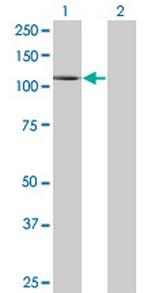 PLD1 Antibody in Western Blot (WB)