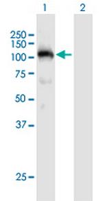 PLG Antibody in Western Blot (WB)