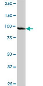 PLG Antibody in Western Blot (WB)