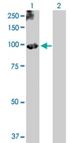 PLG Antibody in Western Blot (WB)