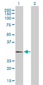 PLP1 Antibody in Western Blot (WB)