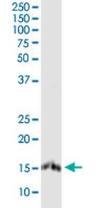 PLP2 Antibody in Western Blot (WB)