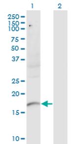 PLXNA2 Antibody in Western Blot (WB)