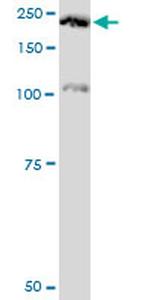 PLXNA2 Antibody in Western Blot (WB)