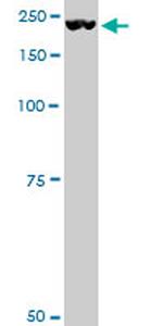 PLXNA2 Antibody in Western Blot (WB)