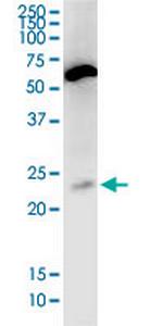 PNOC Antibody in Western Blot (WB)