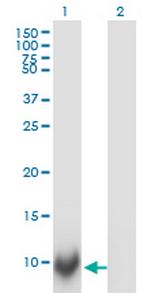 POLR2J Antibody in Western Blot (WB)