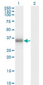 POMC Antibody in Western Blot (WB)