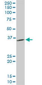 PPA1 Antibody in Western Blot (WB)