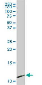 PPBP Antibody in Western Blot (WB)