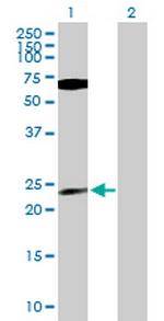 PPP1CB Antibody in Western Blot (WB)