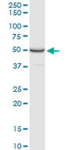 PPP2R2B Antibody in Western Blot (WB)