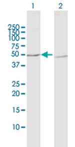 PPP2R2B Antibody in Western Blot (WB)