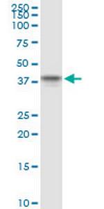 PPP2R4 Antibody in Western Blot (WB)