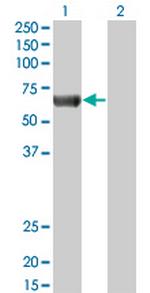 PRKAA2 Antibody in Western Blot (WB)