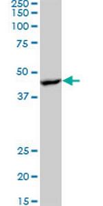 PRKAB1 Antibody in Western Blot (WB)