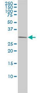 PRKAB2 Antibody in Western Blot (WB)