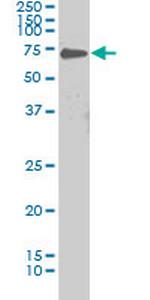 PRKCI Antibody in Western Blot (WB)