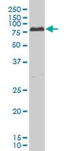 PRKCI Antibody in Western Blot (WB)