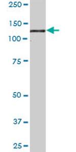 PKN1 Antibody in Western Blot (WB)