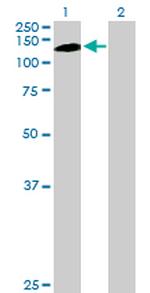 PKN1 Antibody in Western Blot (WB)