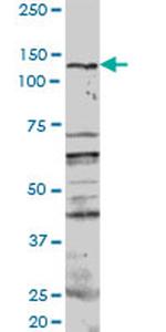 PKN1 Antibody in Western Blot (WB)