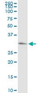 PRKG1 Antibody in Western Blot (WB)