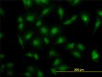 MAPK3 Antibody in Immunocytochemistry (ICC/IF)