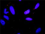 MAPK8 Antibody in Proximity Ligation Assay (PLA) (PLA)