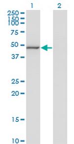 MAPK8 Antibody in Western Blot (WB)