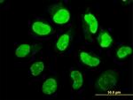 EIF2AK2 Antibody in Immunocytochemistry (ICC/IF)