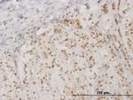 EIF2AK2 Antibody in Immunohistochemistry (Paraffin) (IHC (P))