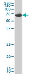 EIF2AK2 Antibody in Western Blot (WB)