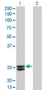 PRL Antibody in Western Blot (WB)