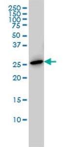 PRL Antibody in Western Blot (WB)