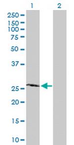 PROP1 Antibody in Western Blot (WB)