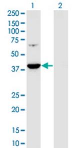 PRPSAP1 Antibody in Western Blot (WB)